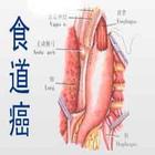 食管肿瘤的诊断标准