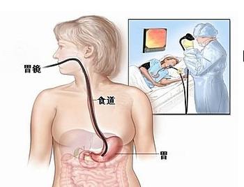 肝肿瘤的诊断方法